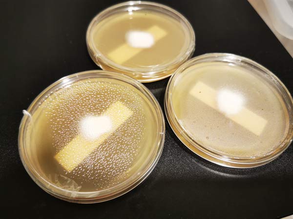 Agar petri dishes with condensation levels